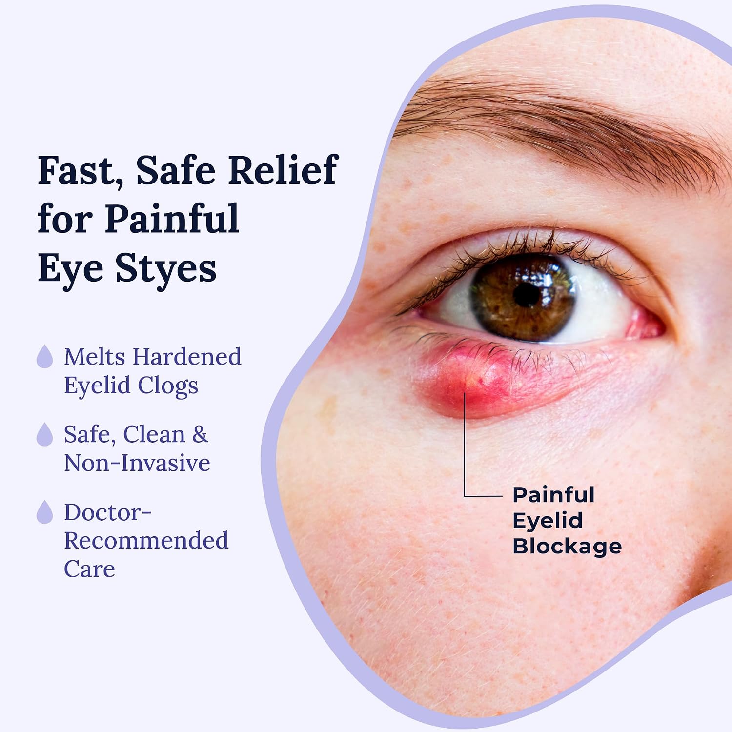 Rest Self Heating Warm Compress for Dry, Tired Eyes | 30 Count | Travel Ready Tired Eye Relief Anywhere | No Microwave Needed | Stye Eye Treament to Soothe Redness, Irritation & Puffiness - view 5
